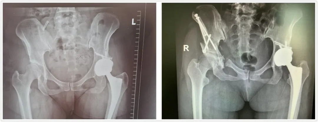 1645144349184703.jpg 1645144349184703.jpg