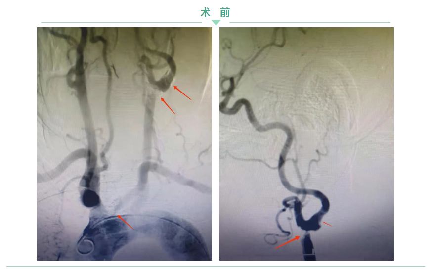 1645665836908966.png 微信截圖_20220224092149.png