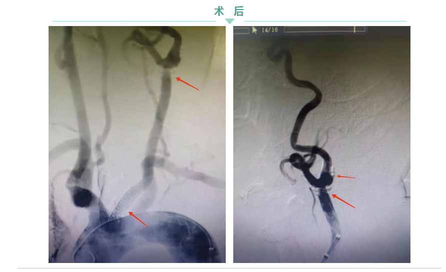 1645665847211746.png 微信截圖_20220224092204.png