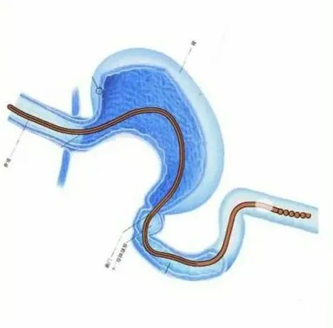 1646186560354040.jpg 1646186560354040.jpg