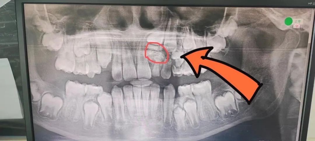 1654477055137554.jpg 1654477055137554.jpg