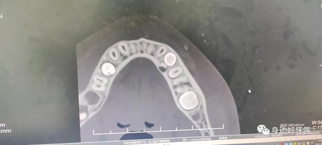 1654477190470303.jpg 1654477190470303.jpg