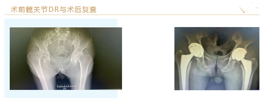 1654737611203695.png 微信截圖_20220609090820.png