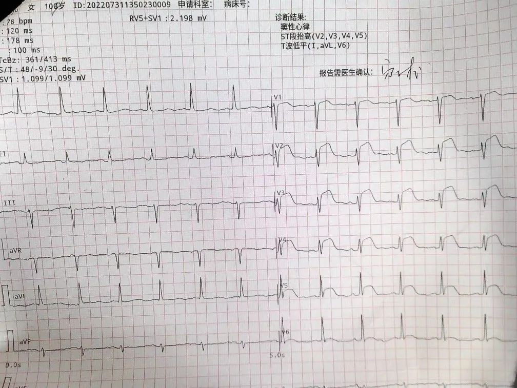 1663637467108655.jpeg 1663637467108655.jpeg