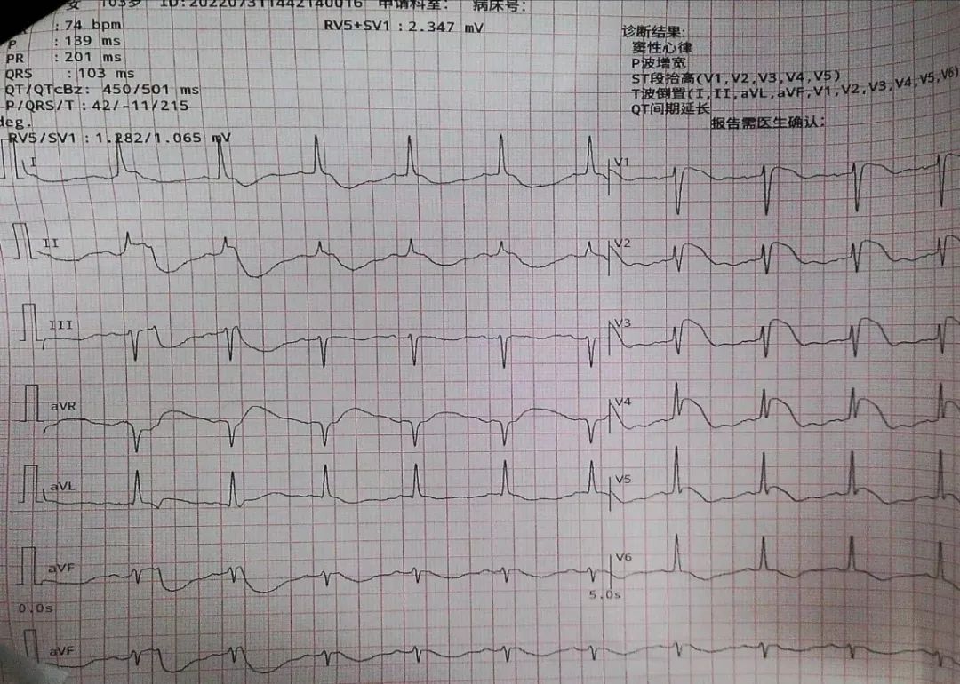 1663637487408315.jpeg 1663637487408315.jpeg